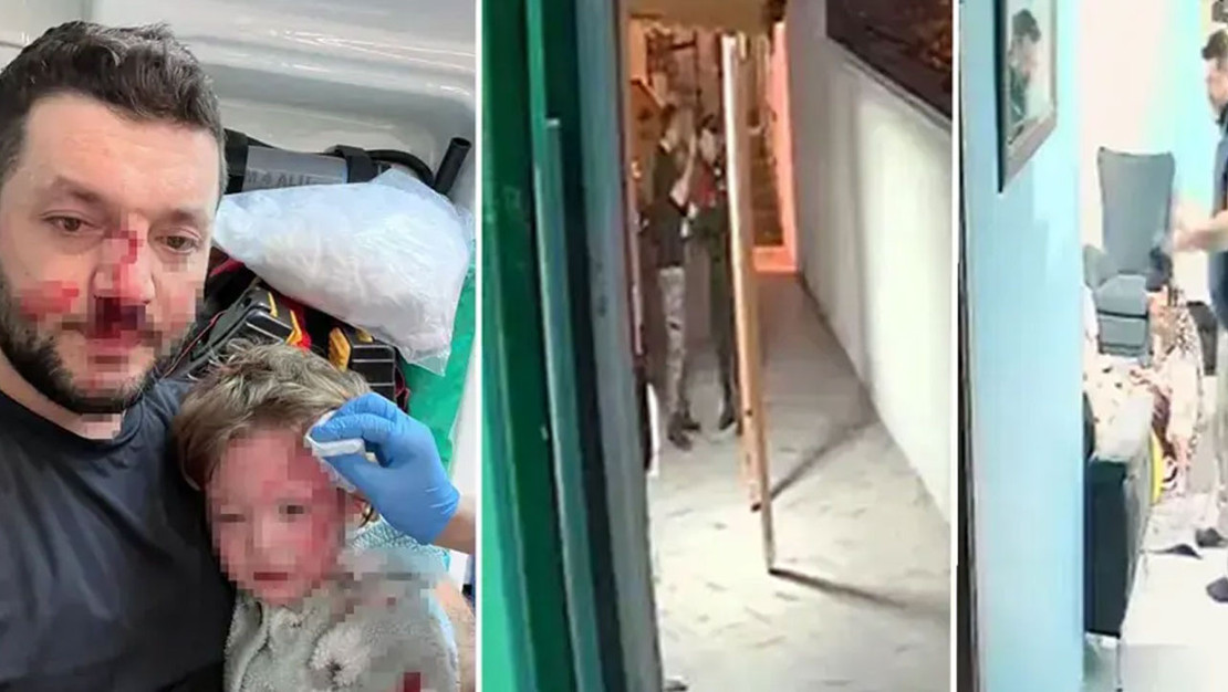 yalova-da-14-aylik-bebege-saldiri-davasi-36-yil-hapis-talep-edildi