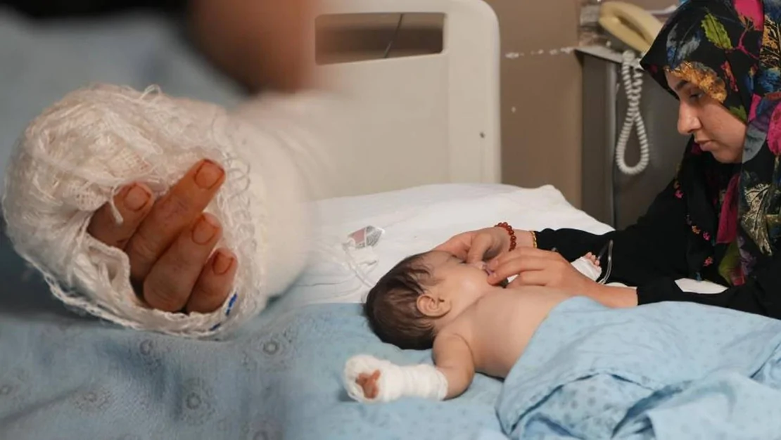 hemsire-bebek-h-s-nin-parmagini-kesti