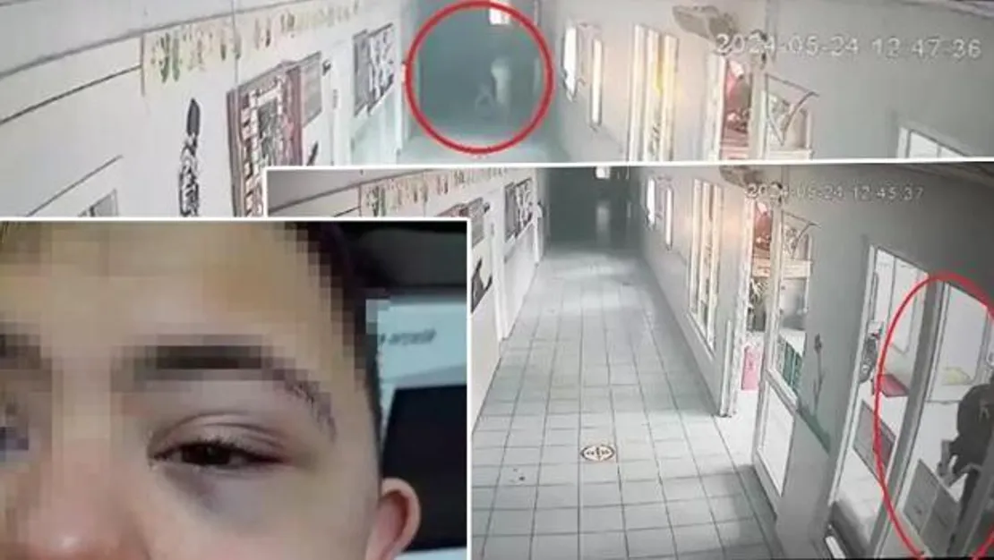 down-sendromlu-ogrenciye-siddet-cezasi-aciklandi