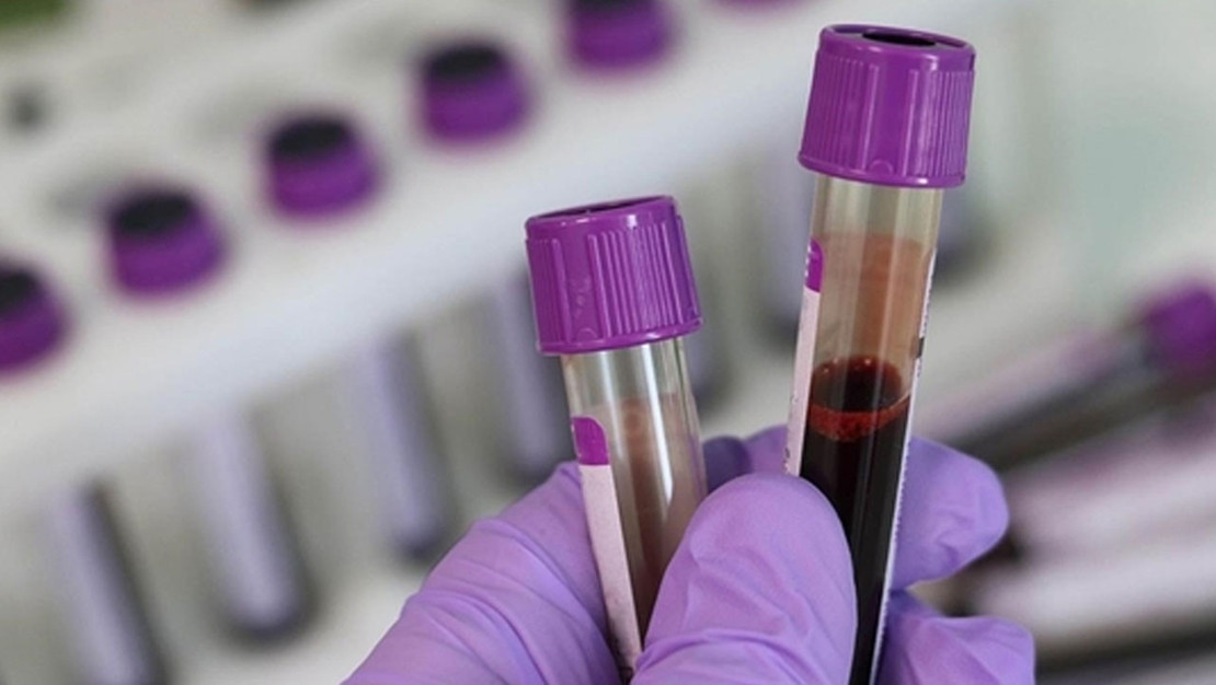 hematolojik-kanserlerde-immunoterapilerle-yeni-donem-basliyor