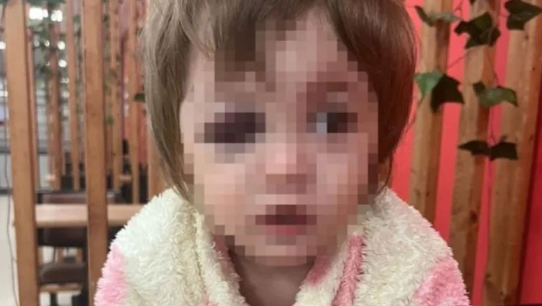 siddet-olayinda-kizini-kucaginda-tasiyan-baba-yaralandi