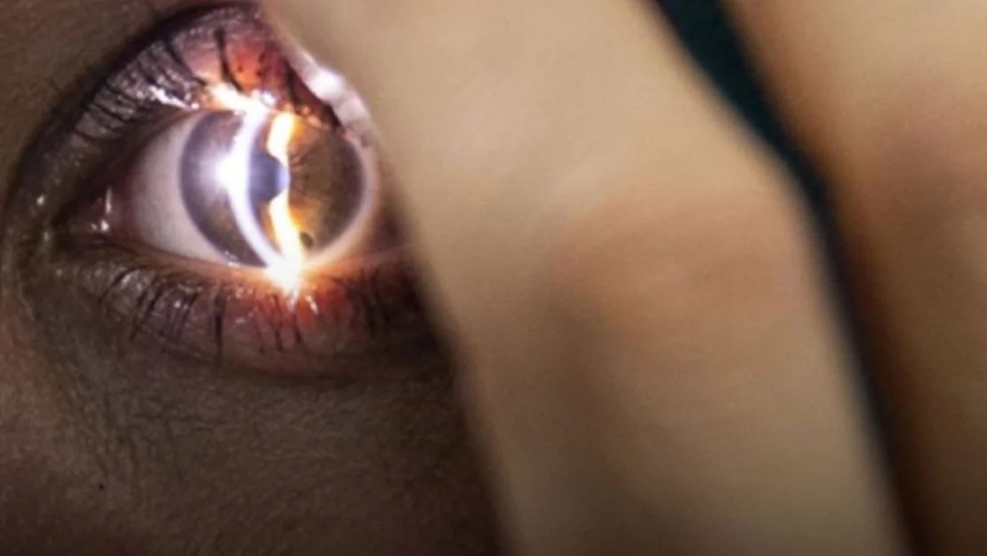 goz-tedavisinde-elektrik-akimi-umut-veriyor