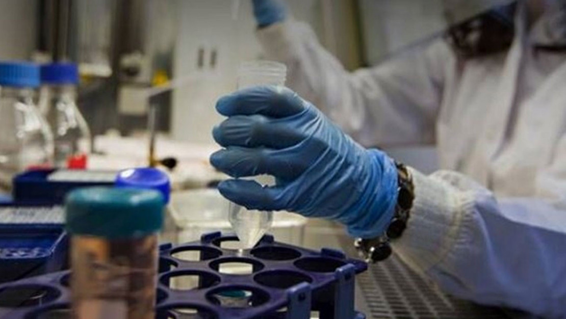 afganistan-da-dna-test-laboratuvari-acildi