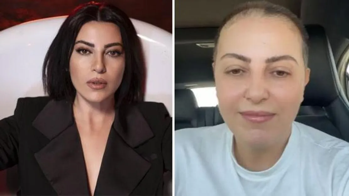 kanserle-mucadele-eden-sarkicidan-duygusal-mesaj