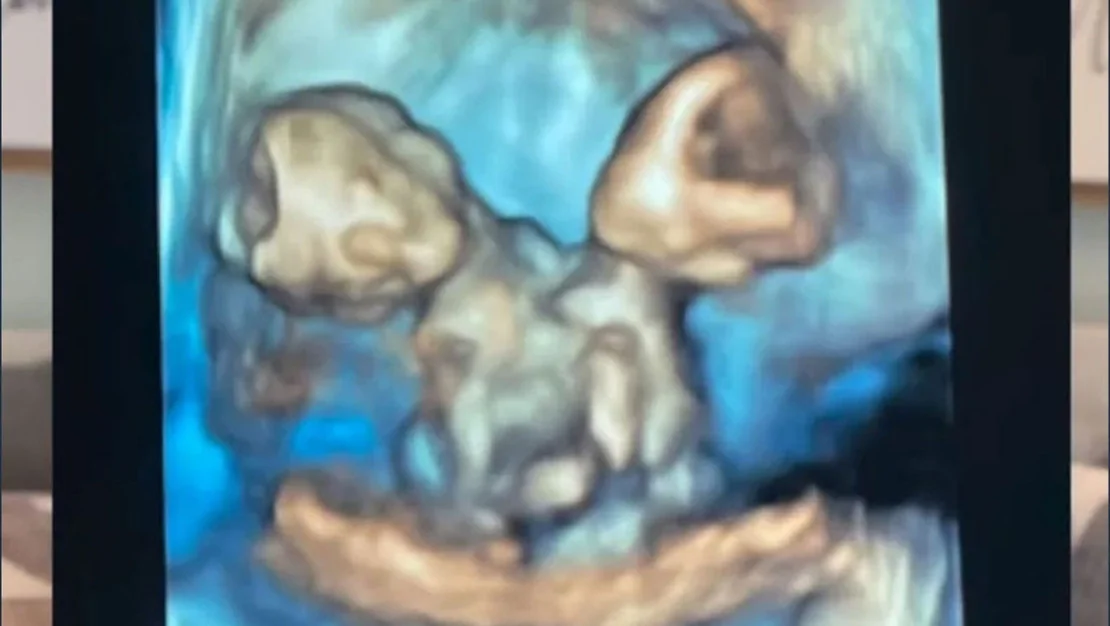 nicole-ve-austin-in-bebek-sevinci-surdu