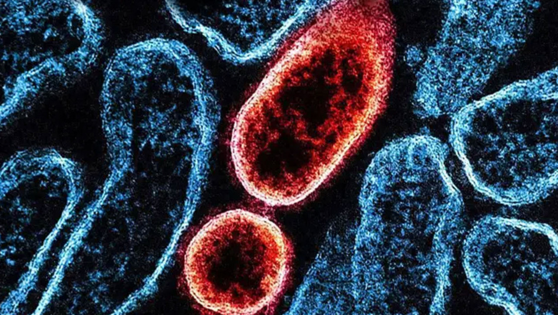 nipah-virusu-hindistan-da-alarm-zilini-caldirdi