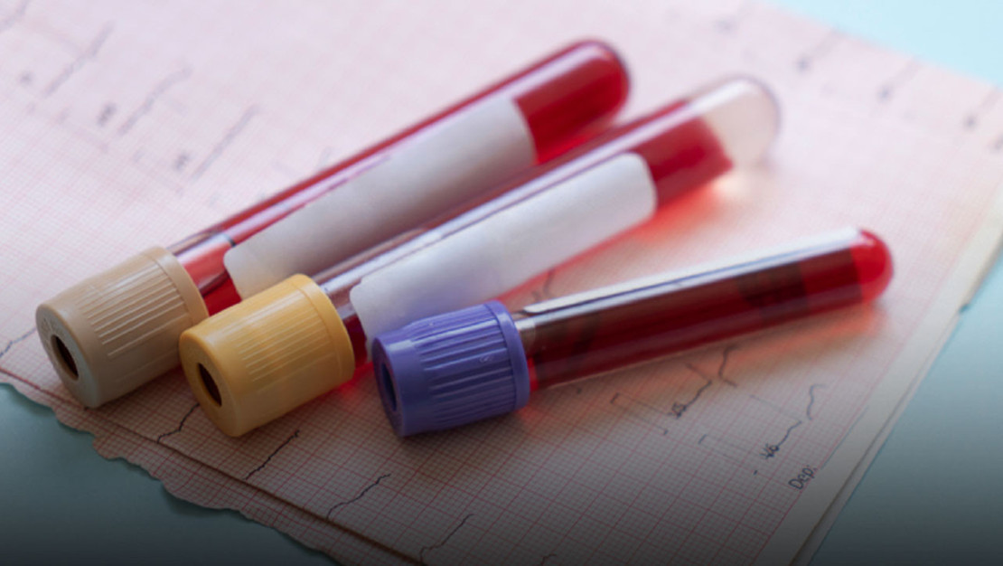 galleri-testi-erken-kanser-tespiti-sagliyor