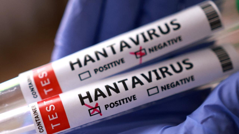 hantavirus-iddialarina-saglik-bakanligi-ndan-yanit