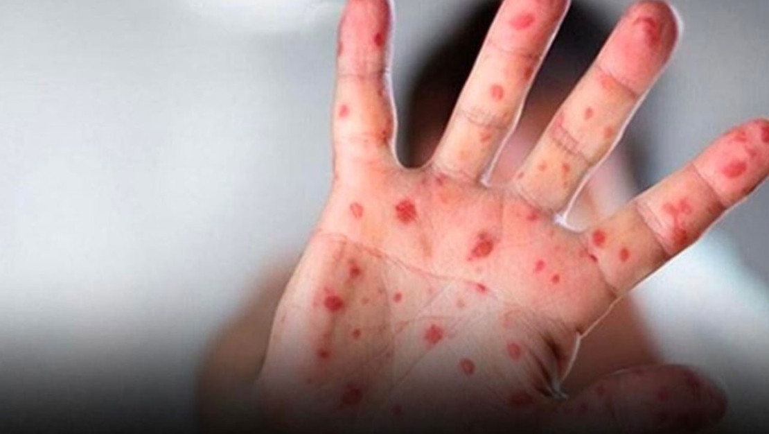 dso-uyariyor-salgin-kontrol-altina-alinmazsa-yayilacak