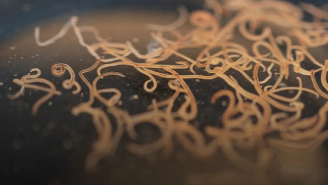 ciddi-parazit-tehlikesi-vucutta-yayiliyor