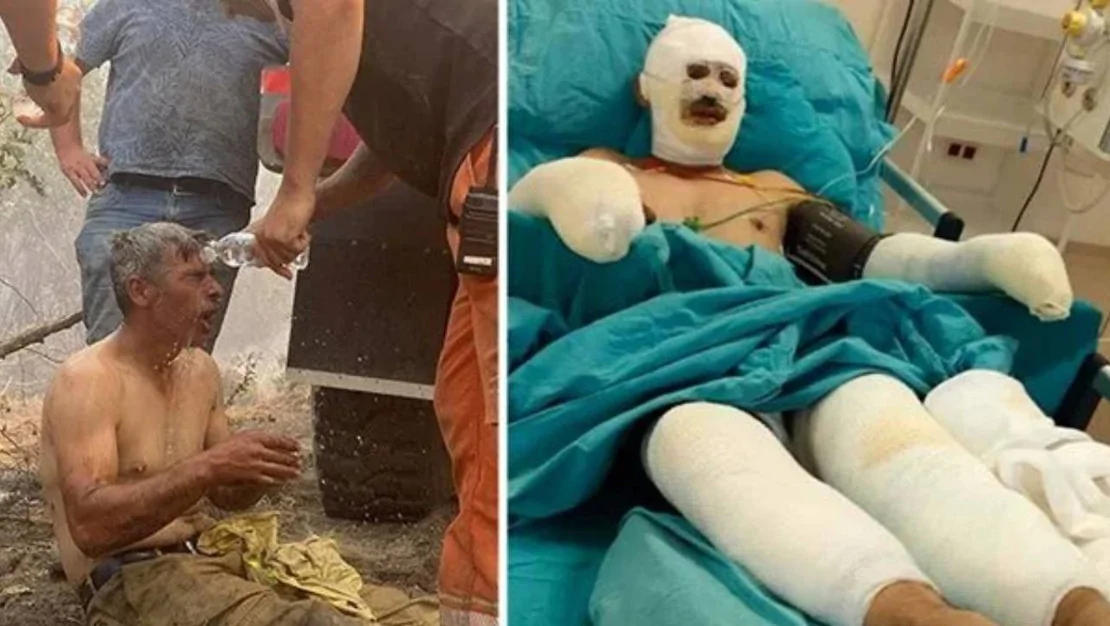 seyitgazi-yangininda-kader-dereli-yaralandi