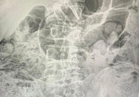 uyusturucu-midelerinde-tasiyan-4-sahis-tutuklandi