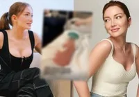 danla-bilic-kalca-dolgusunu-anlatti