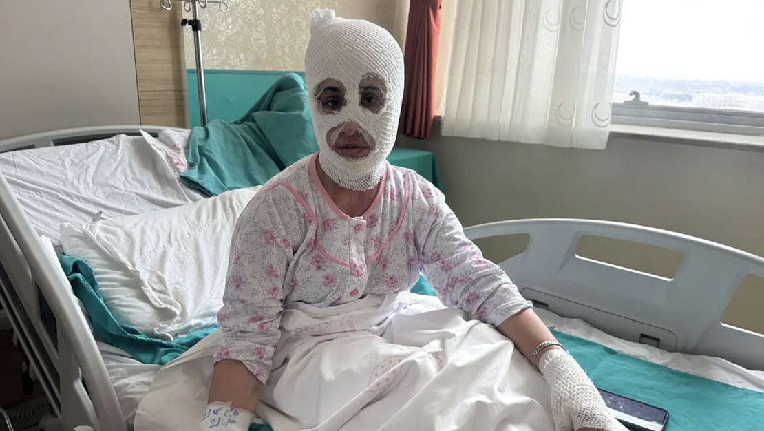 agri-da-iftar-hazirliginda-duduklu-patladi-yaralandi