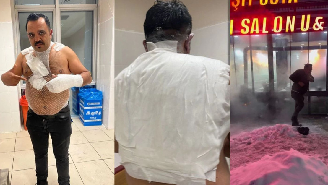 sicak-su-deneyi-tostcuyu-aci-icinde-birakti