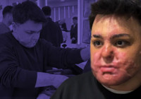 yangin-sonrasi-hayata-donus-mucadelesi