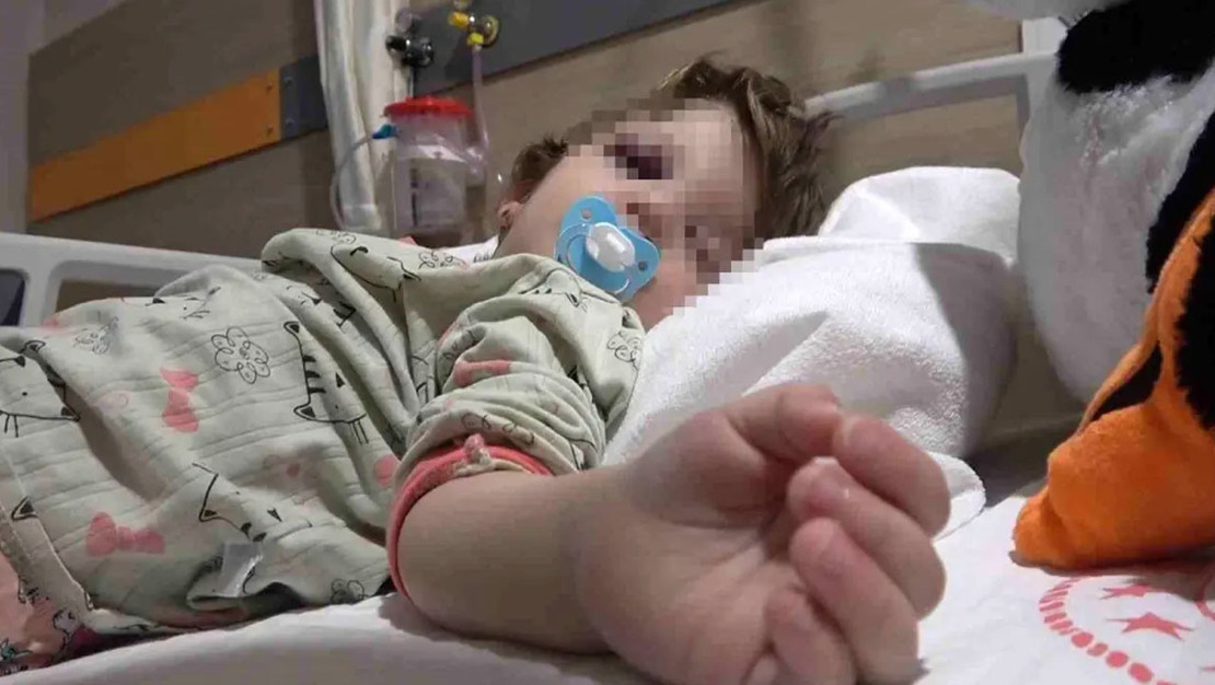 cinarcik-ta-komsu-kavgasinda-bebegin-kafatasi-catladi