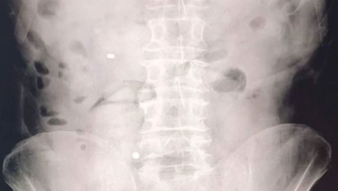 uyusturucu-operasyonunda-1-kilo-70-gram-metamfetamin-ele-gecirildi