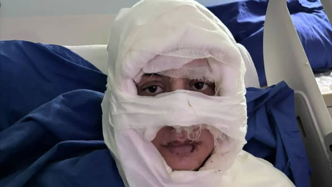 eglence-mekaninda-yanici-maddeyle-saldiri-gerceklesti