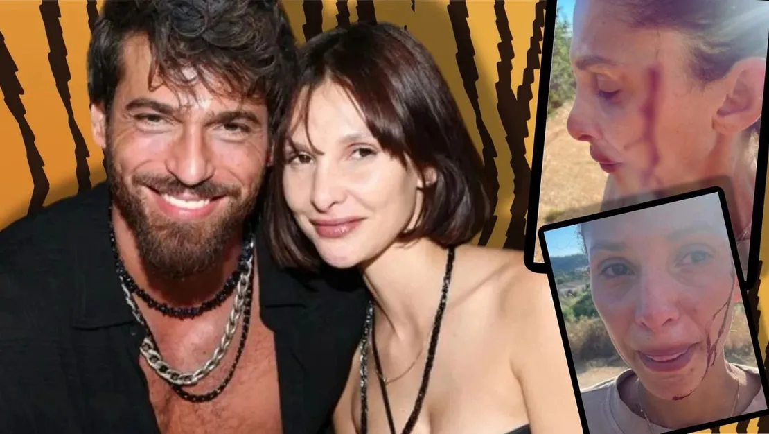 can-yaman-destekledi-siddetle-mucadele-ediliyor