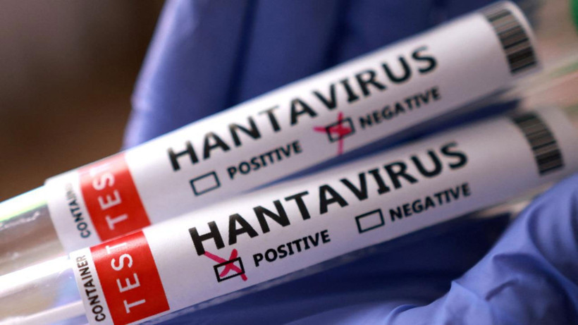 hantavirus-vakalari-arjantin-de-iki-katina-cikti