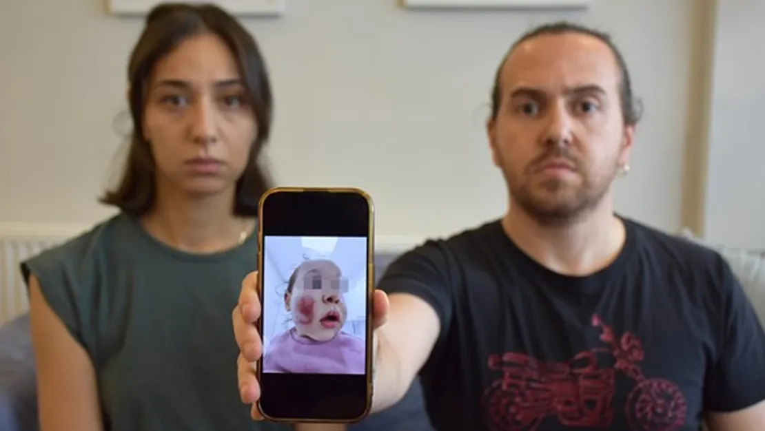 yuzu-parcalanmisti-morluk-icindeydi