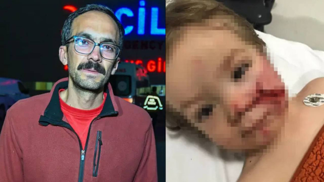 pitbull-kopegin-saldirisinda-iki-cocuk-yaralandi