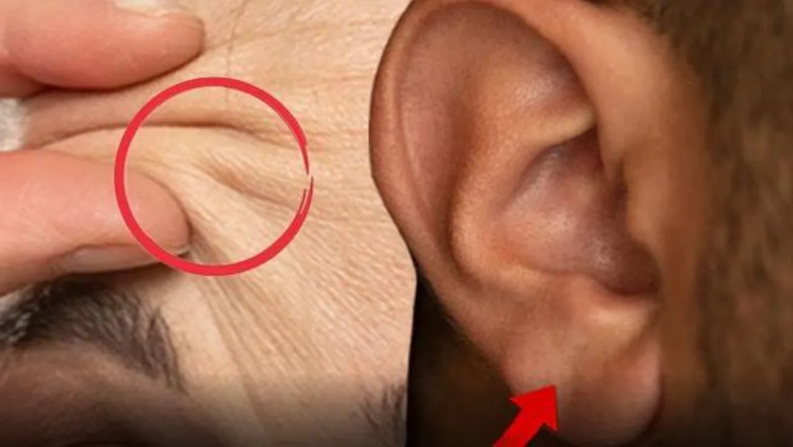 yuzdeki-cizgiler-kalp-hastaligi-belirtisi-mi