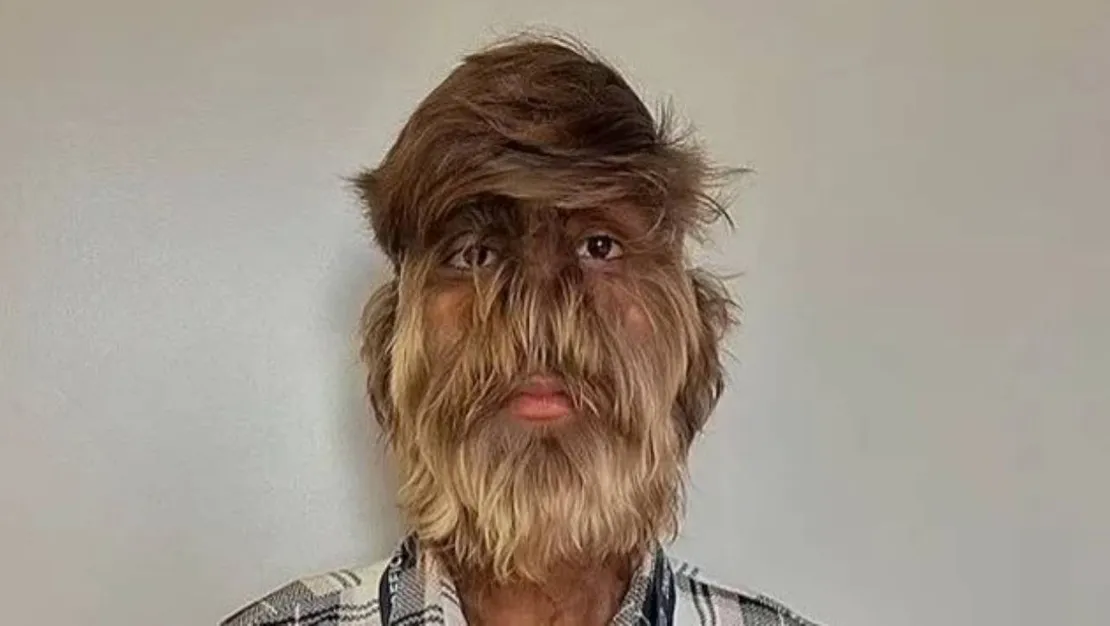 dunyanin-en-killi-yuzu-rekortmeni-18-lik-genc