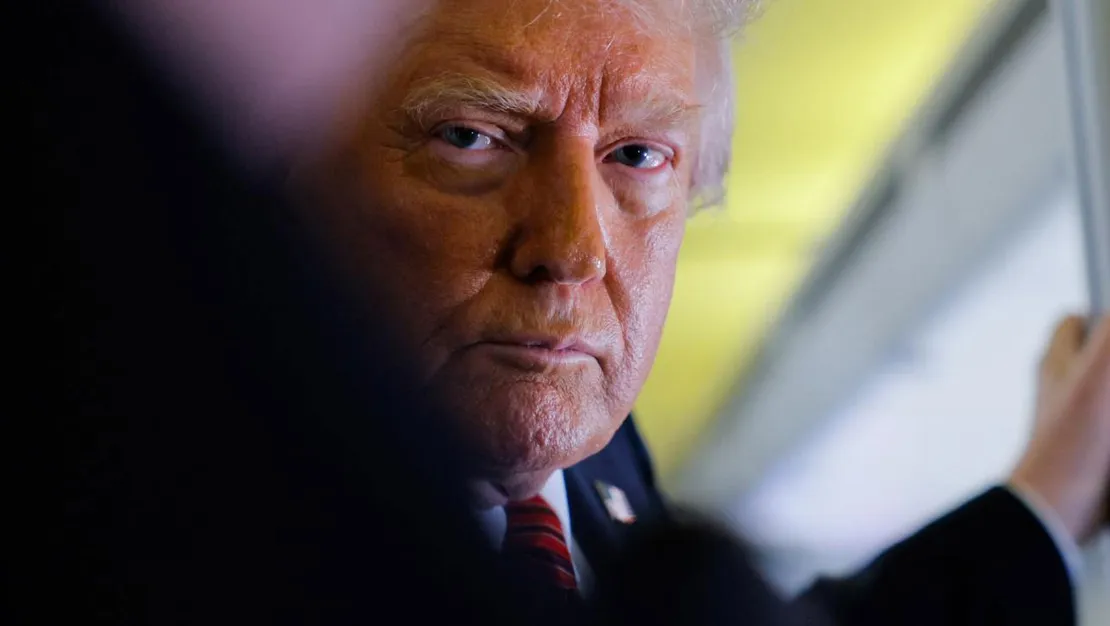 trump-in-kronik-venoz-yetmezligi-teshis-edildi