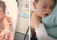 aren-bebek-siddet-gordu