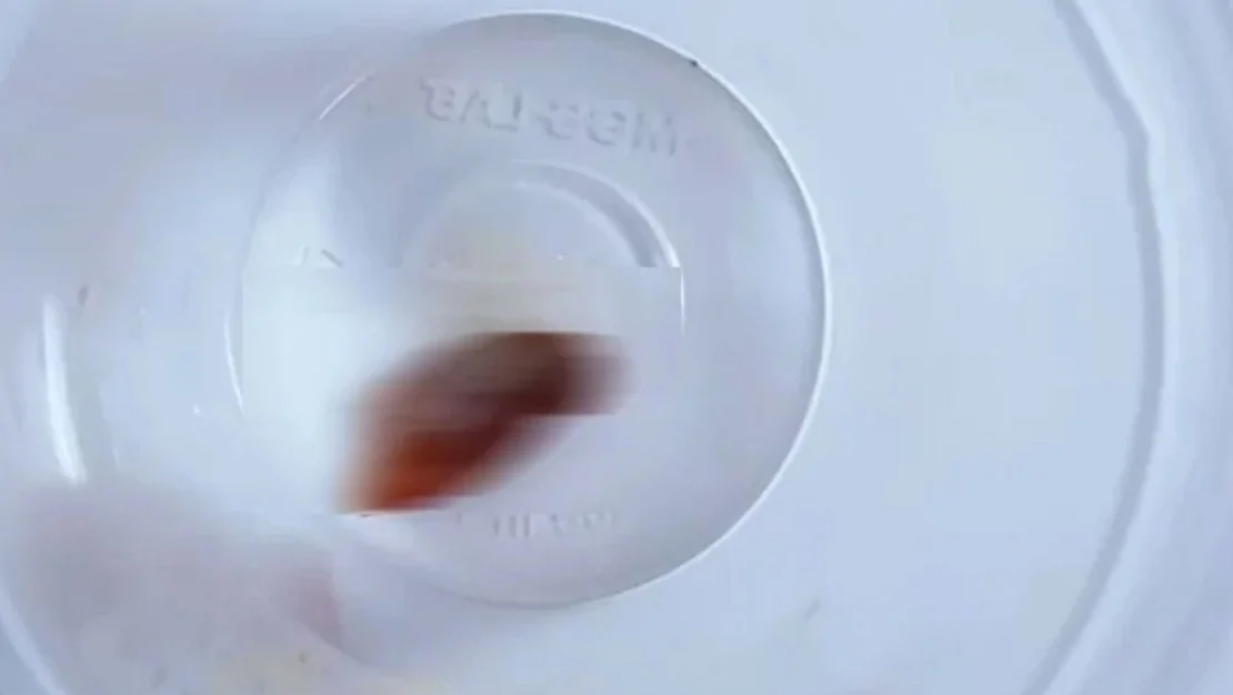 oksurugun-nedeni-ortaya-cikti