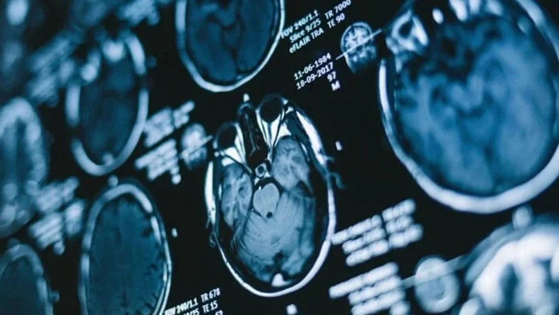 covid-19-beyin-yaslanmasini-hizlandiriyormus