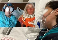 teyzesinin-gozlerini-oydu-sizofreni